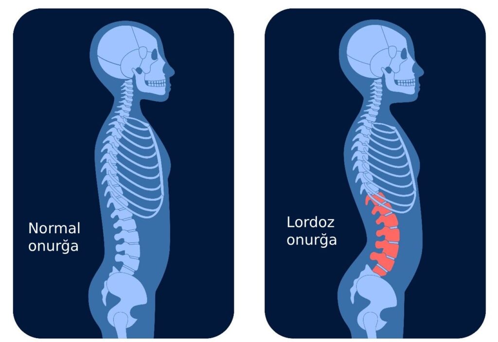 lordoz