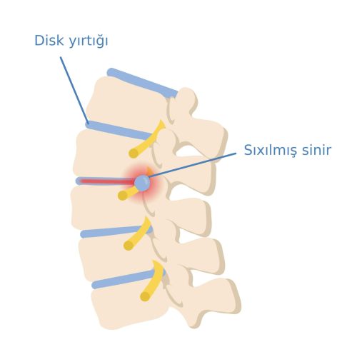 disk yirtigi disk yirtigi